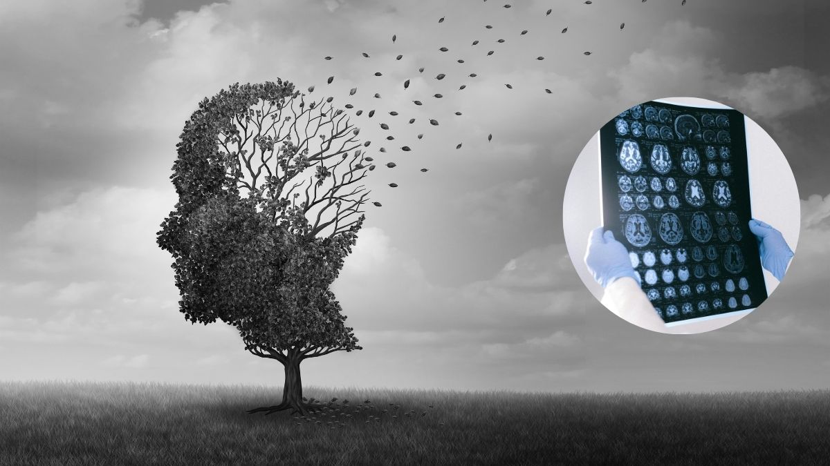 छोटी भूल से बड़ी मुसीबत: क्यों अल्जाइमर को ‘साइलेंट महामारी’ कहा जा रहा है