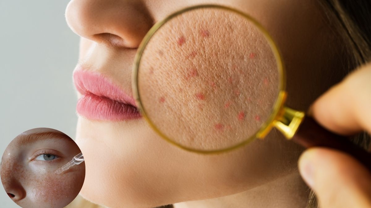 सर्दियों में इन vitamins की कमी से त्वचा हो जाती है रूखी और बेजान, जानिए कैसे रखें स्किन को हेल्दी और ग्लोइंग